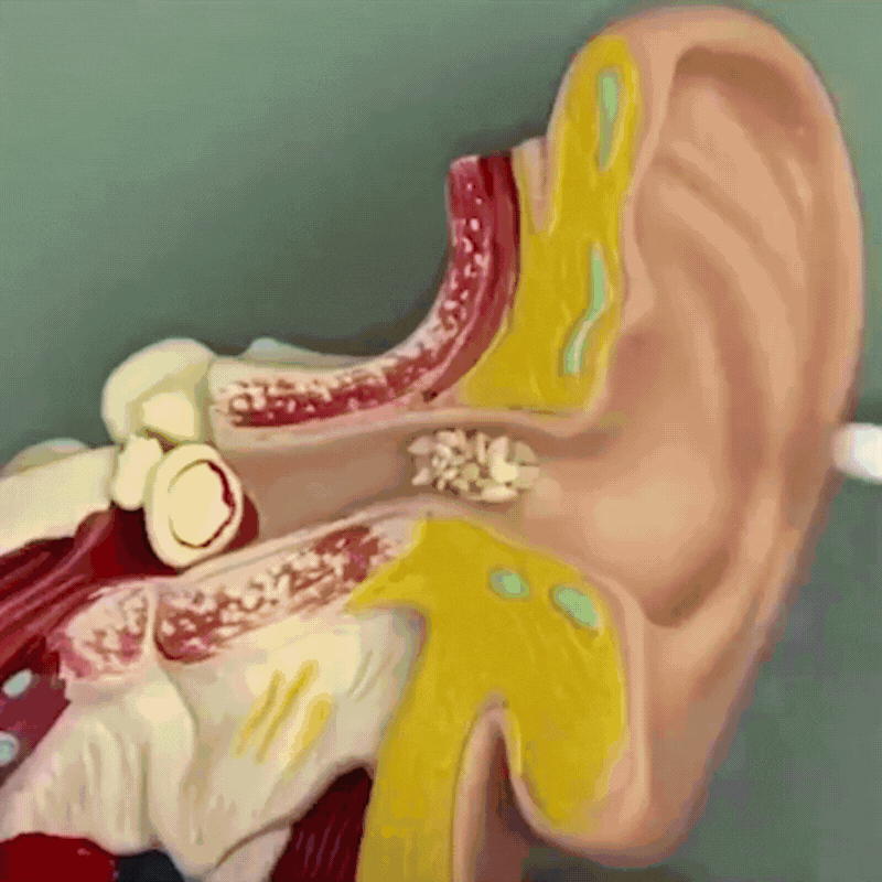 🔥Hot Sale🔥 Earwax Vacuum – Safe & Painless Ear Cleaning for the Whole Family