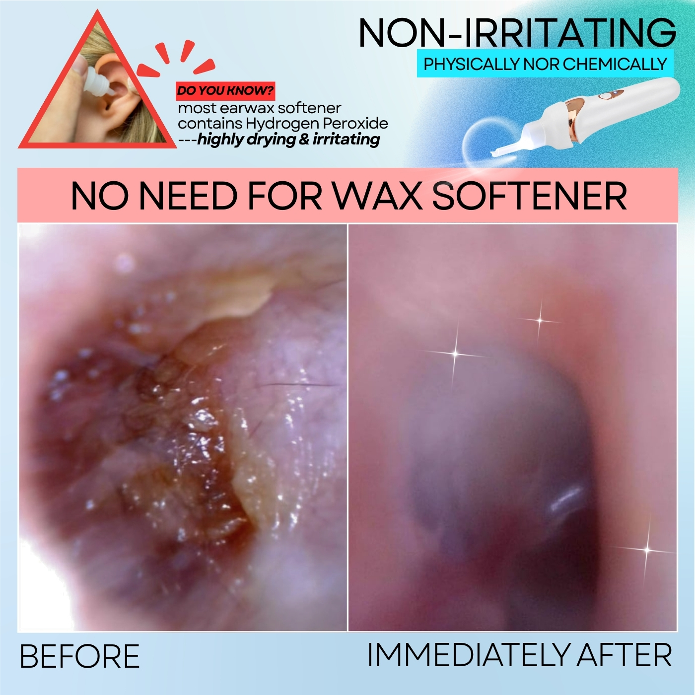 🔥Hot Sale🔥 Earwax Vacuum – Safe & Painless Ear Cleaning for the Whole Family